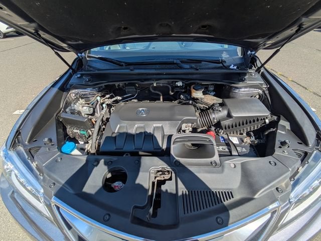 2018 Acura RDX Technology Package